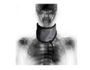 Protège thyroide Strata éq pb 0,50 mm - Modèle TSS Velcro